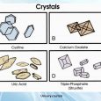 Urinary crystals, Crystals in urine symptoms, causes, treatment, diganosis, home remedies