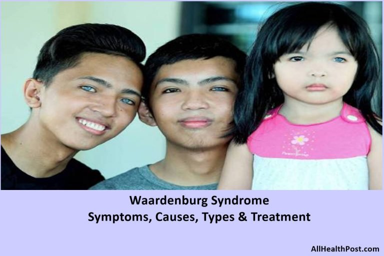 Waardenburg Syndrome Symptoms Causes Types And Treatment