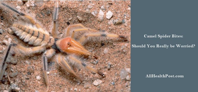 Camel Spider Bites – Should You Really be Worried? - All Health Post